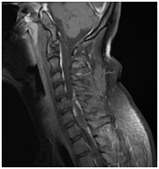 MRI gerinc Nyizsnyij Novgorod árak