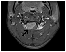 MRI gerinc Nyizsnyij Novgorod árak