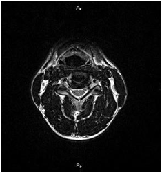 MRI gerinc Nyizsnyij Novgorod árak