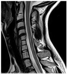 MRI gerinc Nyizsnyij Novgorod árak