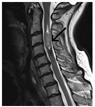 MRI gerinc Nyizsnyij Novgorod árak