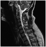 MRI gerinc Nyizsnyij Novgorod árak