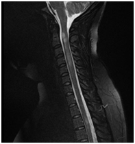 MRI gerinc Nyizsnyij Novgorod árak