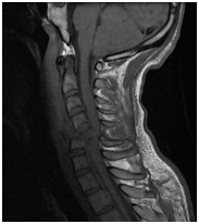 MRI gerinc Nyizsnyij Novgorod árak