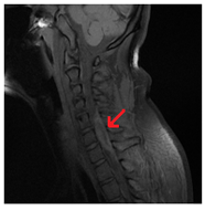 MRI gerinc Nyizsnyij Novgorod árak