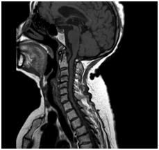 MRI gerinc Nyizsnyij Novgorod árak