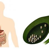 Remediile populare pentru pancreatită și colecistită sunt apa minerală, ierburi, marar, cicoare, ovăz,