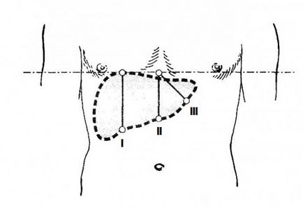 Determinarea mărimii ficatului prin metoda percuției percuției la copii și adulți
