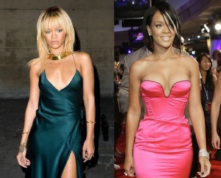 A plasztikai sebészet Rihanna haja Rihanna - 300