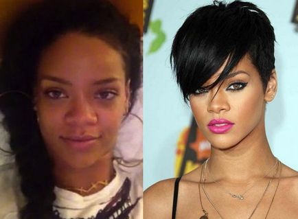 A plasztikai sebészet Rihanna haja Rihanna - 300 (műveletek) A plasztikai sebészet Rihanna haja Rihanna - 300