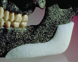 Materialele plastice ale maxilarului