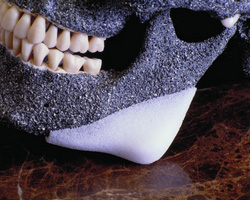 Materialele plastice ale maxilarului