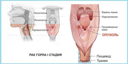 Чому постійно болить горло причини, що робити