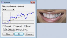 Програми для відбілювання зубів на фото, або як відбілити зуби в fotoshop і