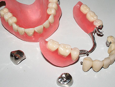 Протезування зубів, вініри і знімні протези в Бердянськ