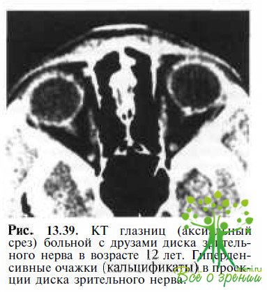 Pseudosteit (pseudostrat)