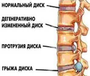 Institutul Neurochirurgic de Cercetare Stiintifica din Rusia