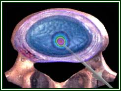 Institutul Neurochirurgic de Cercetare Stiintifica din Rusia