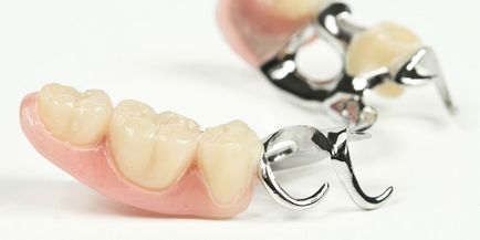 Знімні зубні протези, вартість протезування знімними протезами в стоматологічній клініці
