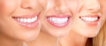 Скільки коштує наростити зуб, поставити коронку, як нарощують передні зуби