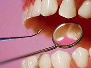 Стоматологічна клініка - експрес дантист
