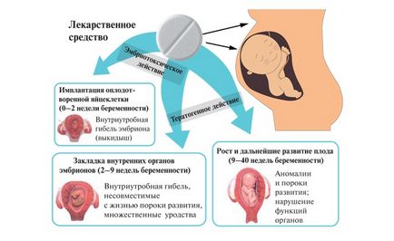 Таблетки при головному болю при вагітності що можна випити вагітним, які таблетки не можна пити