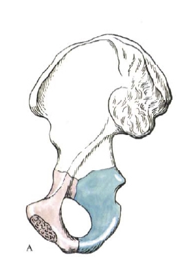 Тазова кістка, клубова кістка (os ilium), секрети здорового життя від Смелаова олександра
