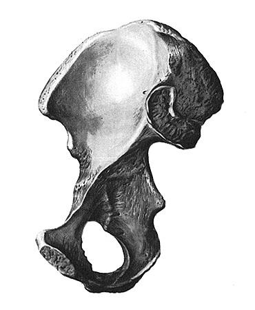 Oasele pelvine, osul iliac (os ilium), secretele vieții sănătoase de la Vladimir Alexandra