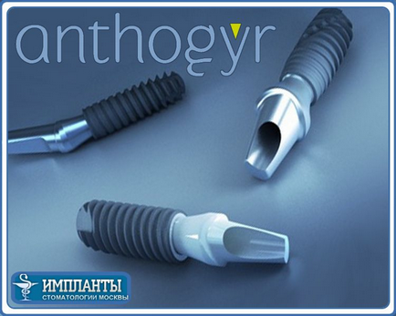 Pentru a instala implanturi dentare antogyr - implantarea de implanturi franceze anto-gumă la dentist