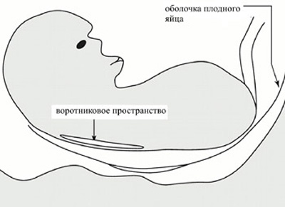 Uzi în 11 12 13 săptămâni cu sarcină prima fotografie uzi fotografie în Sankt Petersburg, centrul de medicina fetală