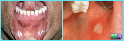 Boli alergice în stomatologie - articole pe