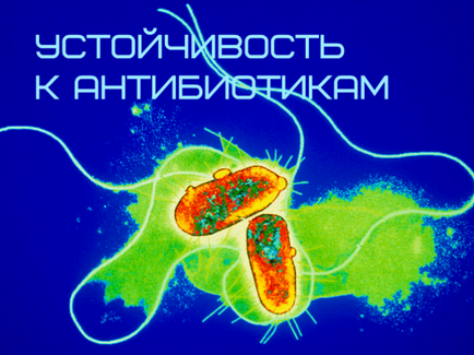 Americanul a fost ucis de o bacterie care este rezistentă la toate antibioticele