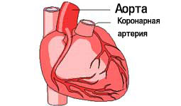 Ateroscleroza aortei simptomelor cardiace și a tratamentului