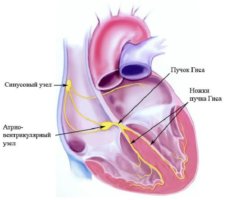 Blocarea piciorului drept al mănunchiului de ghips ce este, diagnosticul și tratamentul