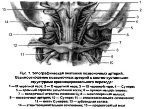 Цервікокраніалгія вертеброгенная лікування цервікокраніалгіі вертеброгенной