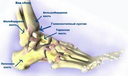 Deformarea artrozei cauzate de glezna cauze, grade, simptome, tratament