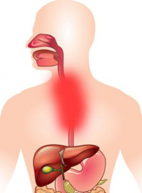 Simptomele și tratamentul esofagitei