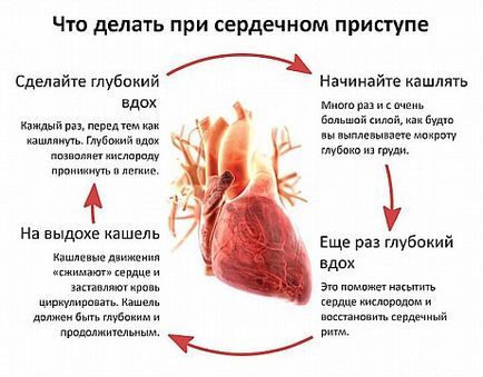 Fizkult hi! Hogyan kell menteni az életét egy szívroham gyógyszeres kezelés nélkül