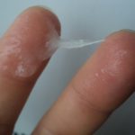 Nőgyógyászati betegség tünetei és az elszigeteltség, mint a gyógyítás, fotók (a betegség) Nőgyógyászati betegség tünetei és az elszigeteltség, mint a gyógyítás, fotók