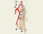 Accident vascular cerebral - tratamentul bolii