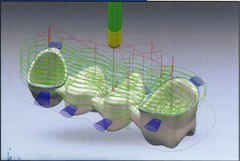 Виготовлення штучних коронок за допомогою cad cam систем в стоматології avantis