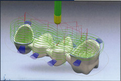 Efectuarea de coroane artificiale cu sisteme cad cam în stomatologie avantis