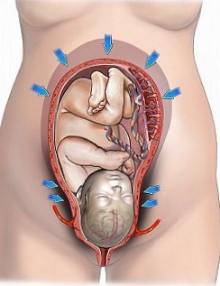 Cum să distingem un tub de lichid amniotic