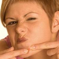 Cum să opriți stoarcerea acneei fără acnee