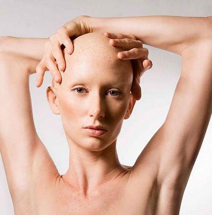Як відновити волосся після хіміотерапії