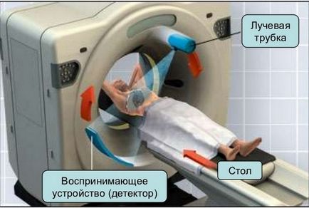 Diagnosticarea CT a creierului este ceea ce este, anatomia; emisie
