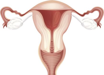 Tratamentul fibromilor uterini