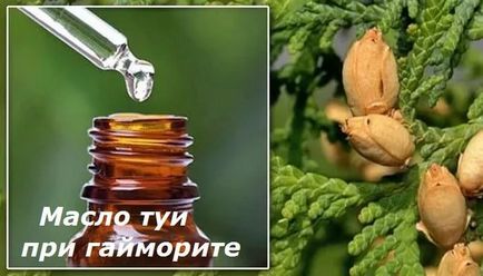 Масло туї при гаймориті спосіб застосування і відгуки