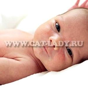 Pielea de marmură la nou-născuți provoacă, indiferent dacă tratamentul este necesar