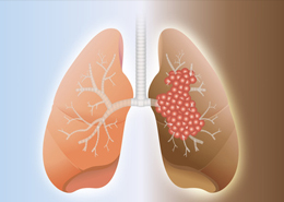 Clinici oncologice din Israel, recenzii, preturi, comentarii